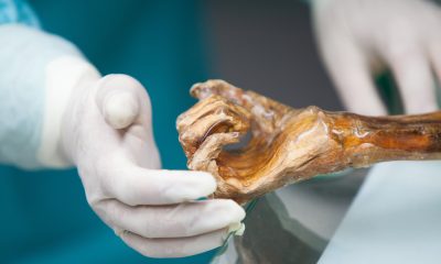 the-microbes-of-otzi-the-iceman-awaken-thousands-of-years-after-his-death