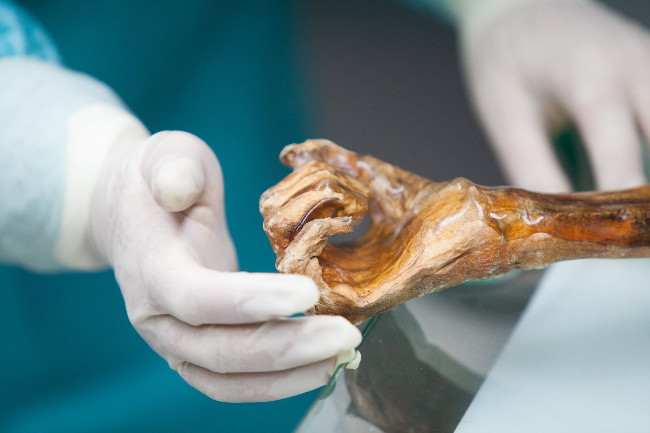 the-microbes-of-otzi-the-iceman-awaken-thousands-of-years-after-his-death