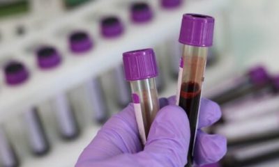 hundreds-of-costa-del-sol-patients-wrongly-told-they-may-have-colon-cancer-after-malaga-hospital-lab-sends-false-positives