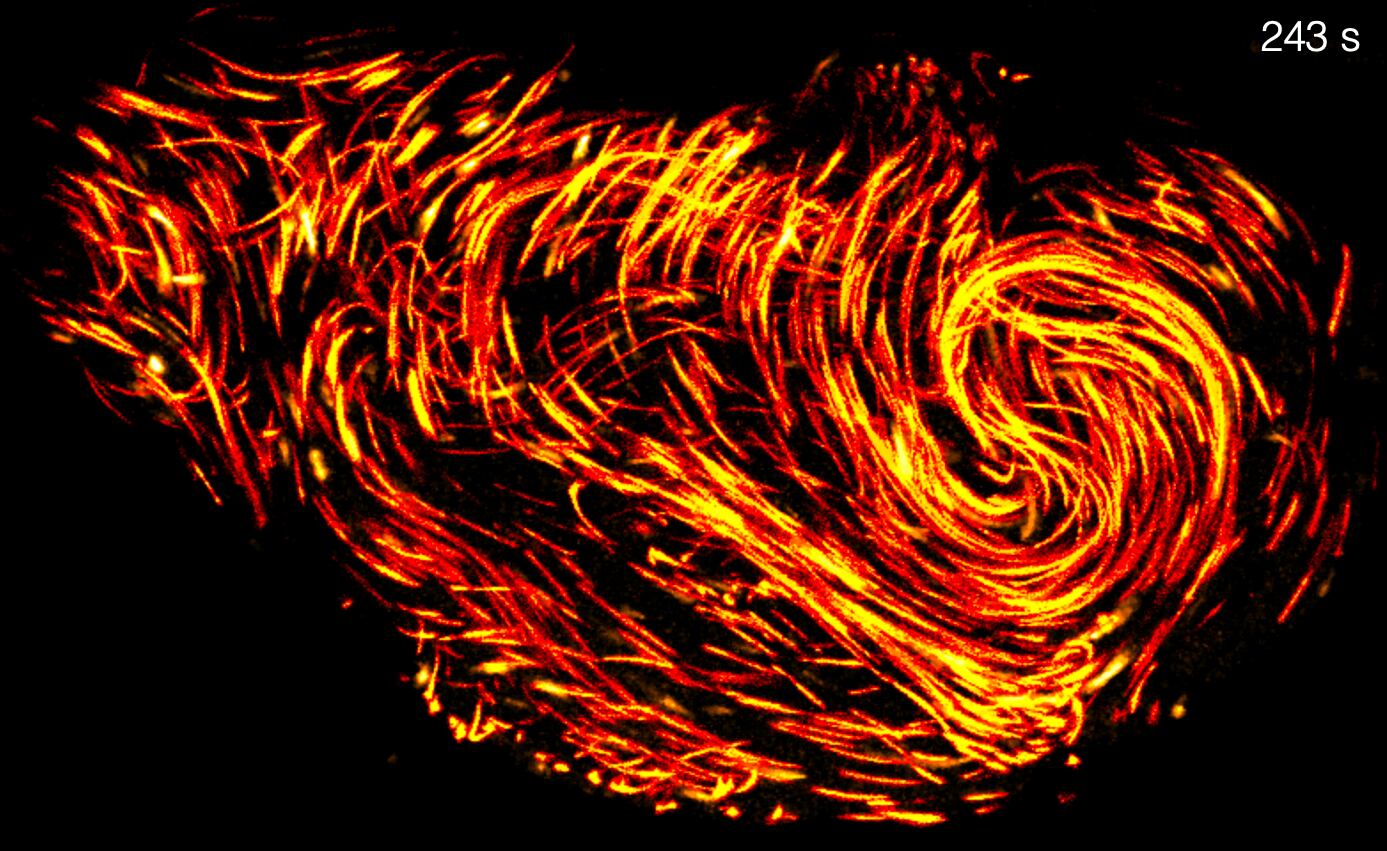 how-thousands-of-sperm-squeeze-into-a-space-10-times-smaller-without-getting-tangled