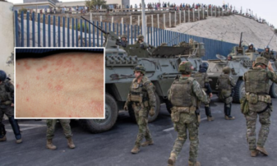 ceuta-scabies-outbreak-located-to-military-barracks-in-the-spanish-enclave-and-‘not-linked-to-recent-migrant-crisis’