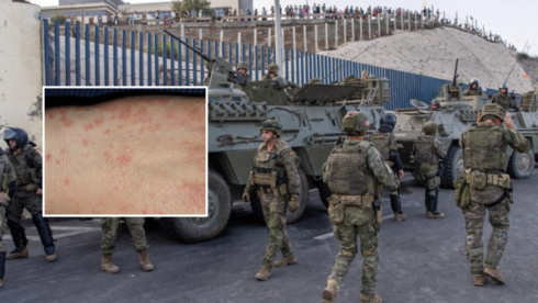 ceuta-scabies-outbreak-located-to-military-barracks-in-the-spanish-enclave-and-‘not-linked-to-recent-migrant-crisis’