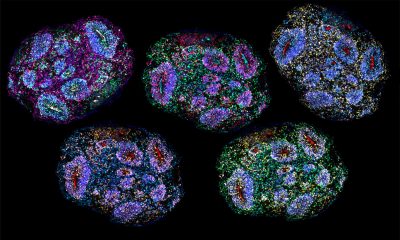 breakthrough-in-neuromedicine-as-human-mini-brains-are-kept-alive-for-years
