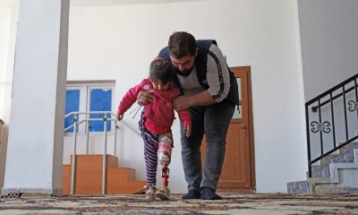 3d-printing-returns-hope-to-amputees-in-syria