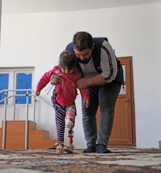 3d-printing-returns-hope-to-amputees-in-syria