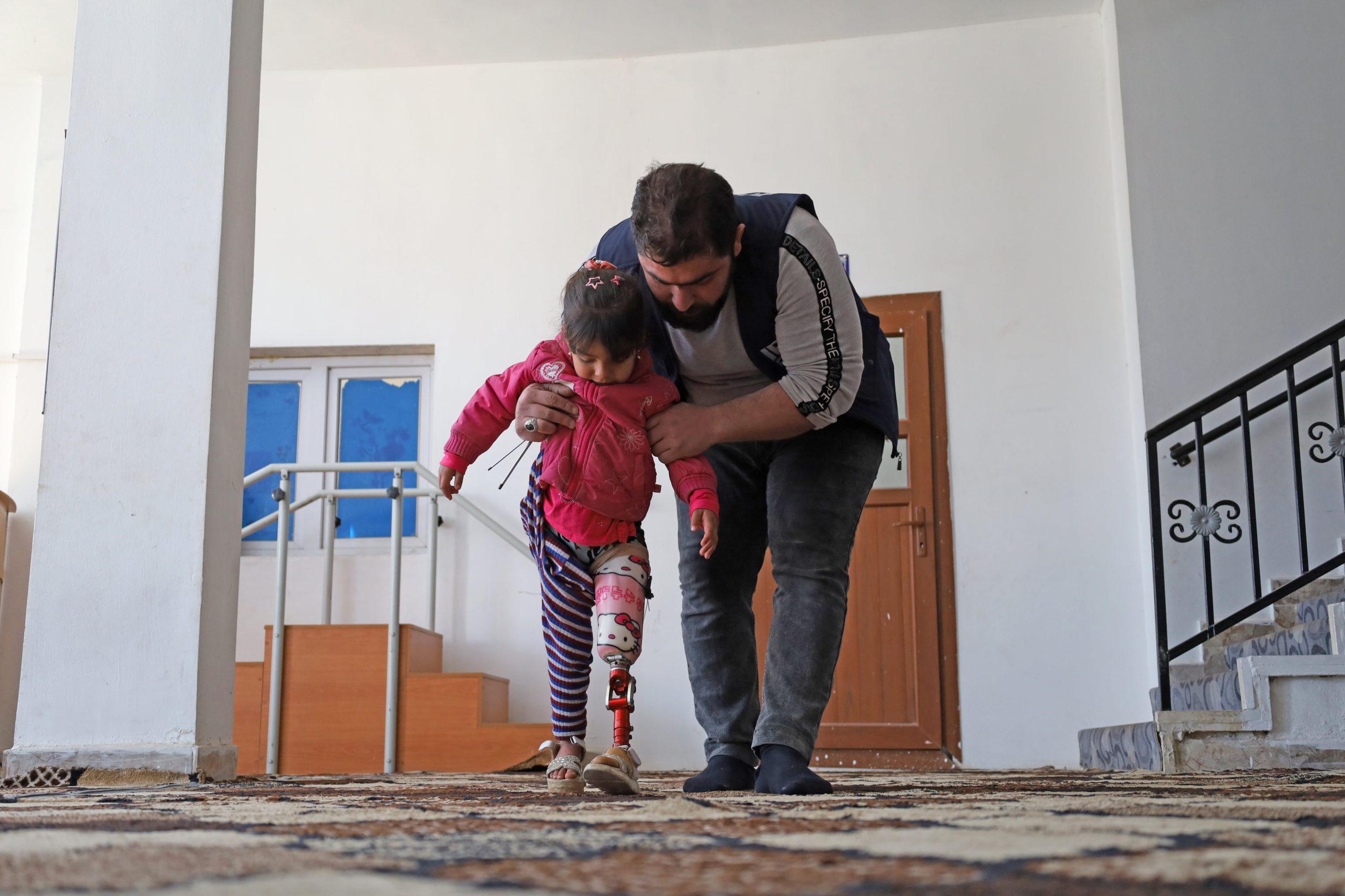 3d-printing-returns-hope-to-amputees-in-syria