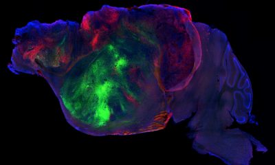 mice-with-millions-of-human-neurons-in-their-brains-bring-scientists-closer-to-understanding-mental-disorders