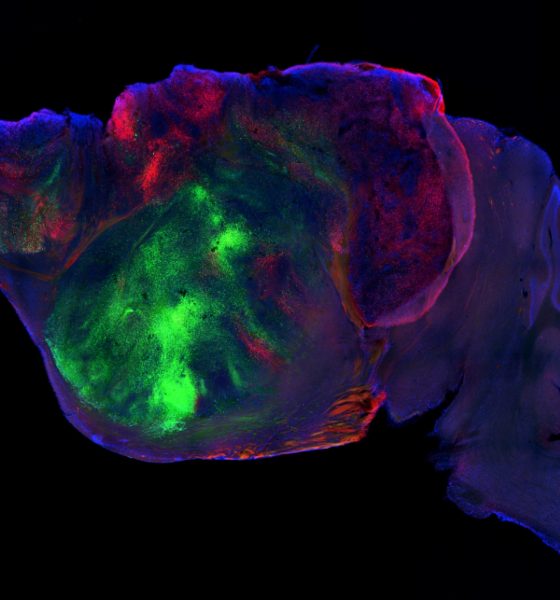mice-with-millions-of-human-neurons-in-their-brains-bring-scientists-closer-to-understanding-mental-disorders