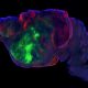 mice-with-millions-of-human-neurons-in-their-brains-bring-scientists-closer-to-understanding-mental-disorders