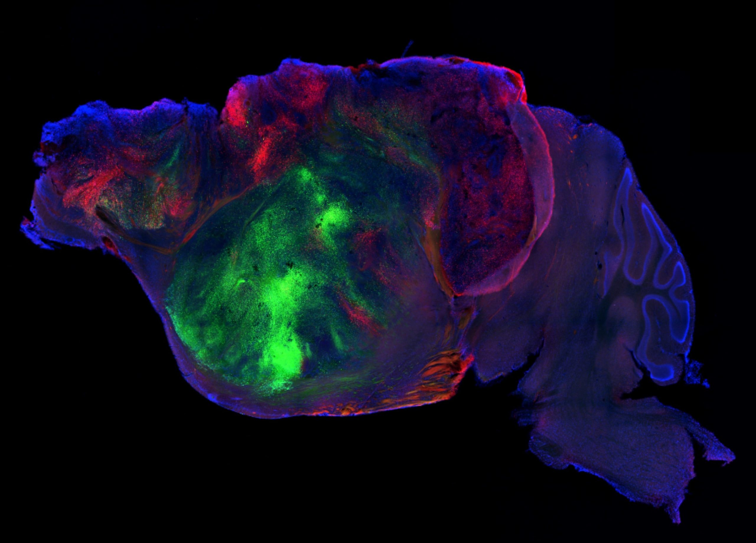 mice-with-millions-of-human-neurons-in-their-brains-bring-scientists-closer-to-understanding-mental-disorders