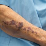 daily-aspirin-guidance:-is-taking-an-aspirin-every-day-still-safe?