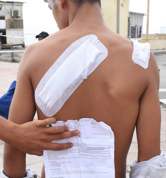 el-hospital-de-ceuta-remite-al-juez-una-veintena-de-partes-de-lesiones-de-inmigrantes-que-dicen-haber-sido-agredidos-por-militares